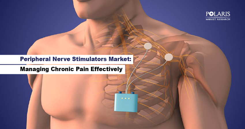 Peripheral Nerve Stimulators Market: Managing Chronic Pain Effectively